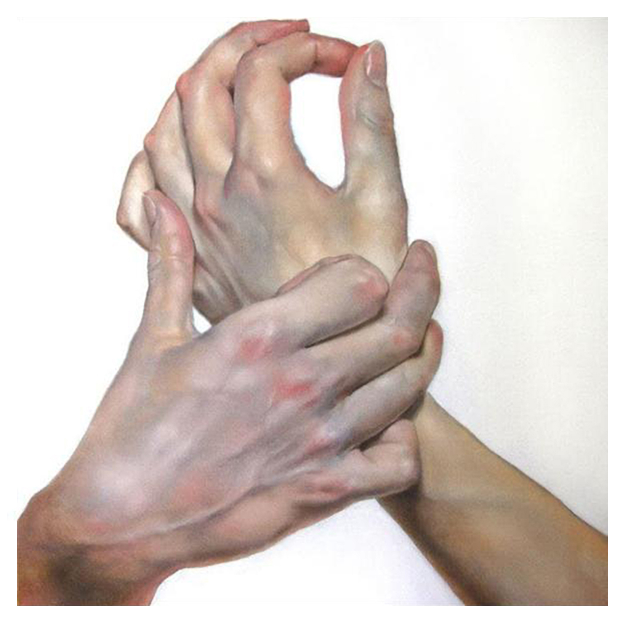 title=